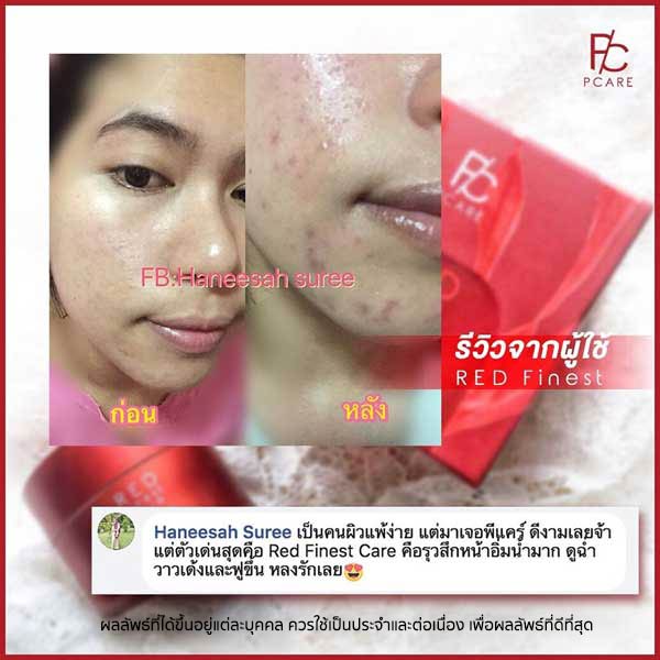 pcare skincare