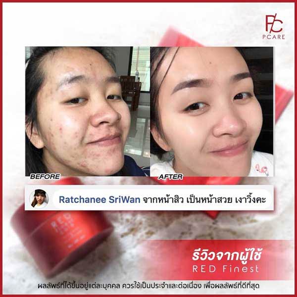 pcare skincare