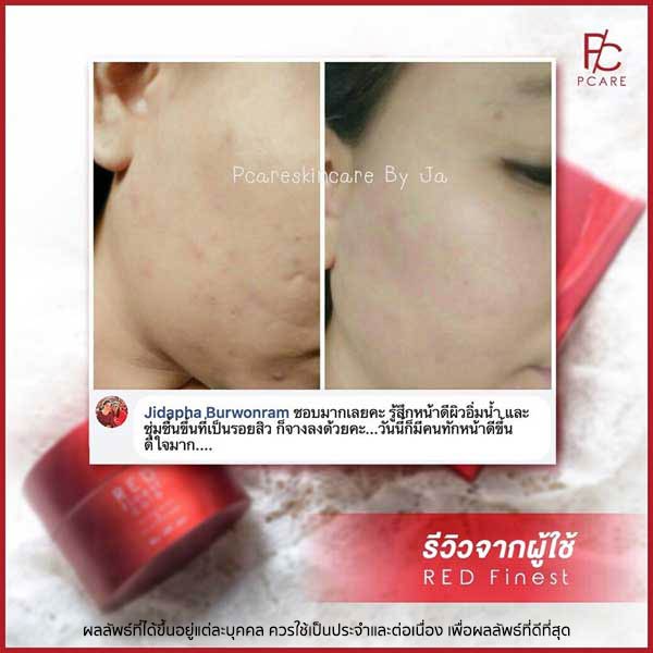 pcare skincare