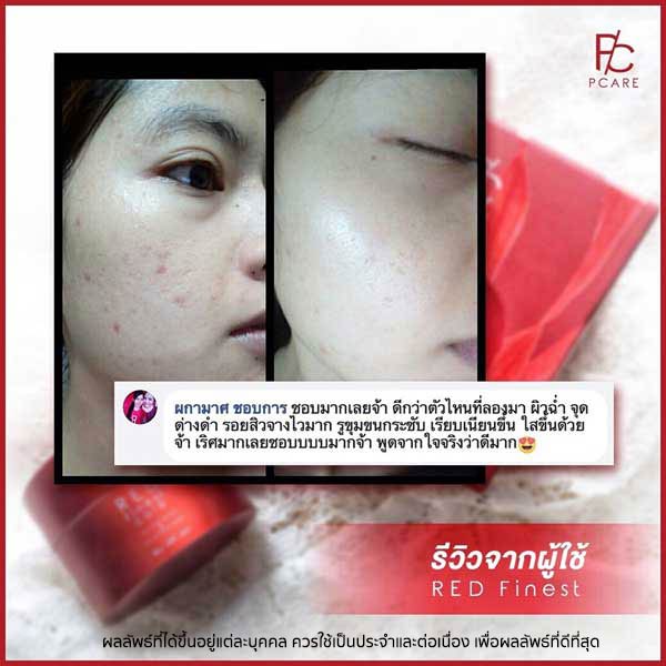 pcare skincare