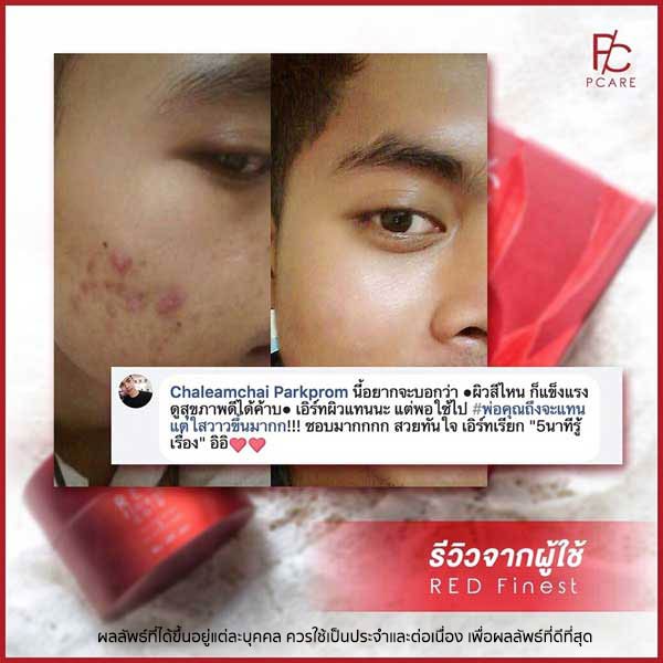 pcare skincare