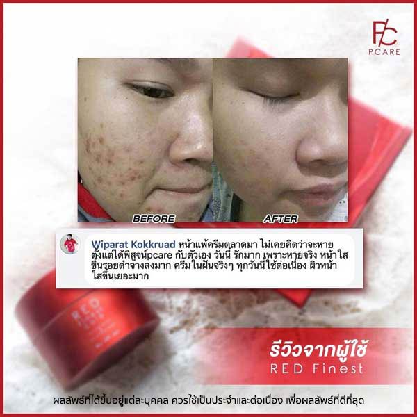 pcare skincare